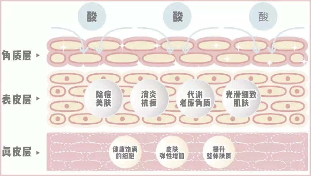 水杨酸|脸上莫名其妙的小疙瘩，到底怎么弄？