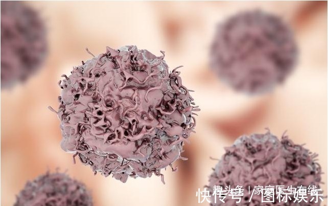 淋巴结肿|预防癌症复发转移,4个小建议请收好,防止癌细胞“越界”!