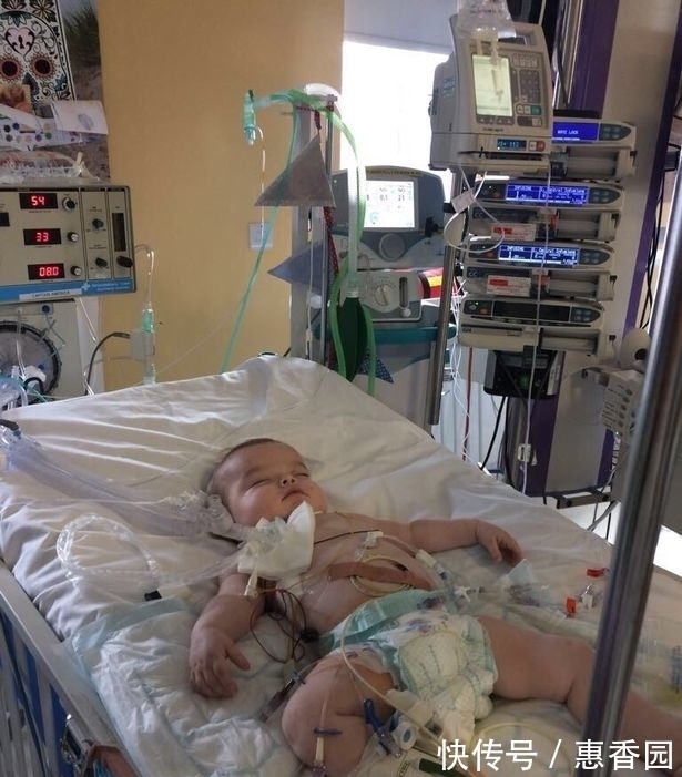 宝宝|宝宝患有罕见疾病,自出生一来就没出过医院