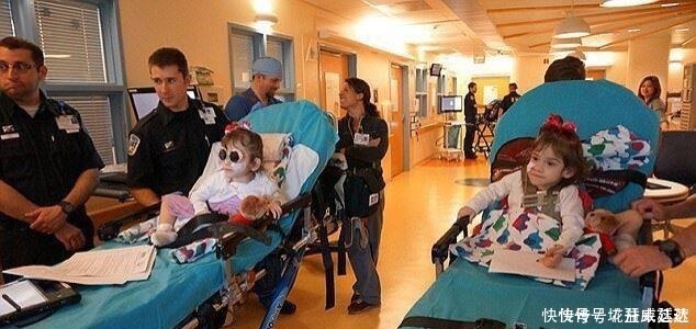 父母|连体双胞胎做分离手术成功,每人分得一条腿,父母喜极而泣!