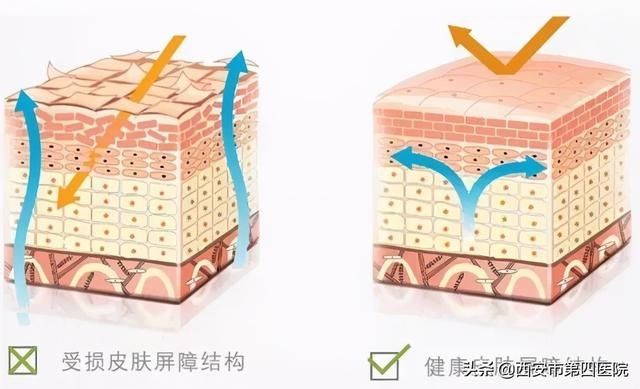 皮肤过敏|#安心变美课堂##我的安心变美推荐# 皮肤过敏急救大法!!