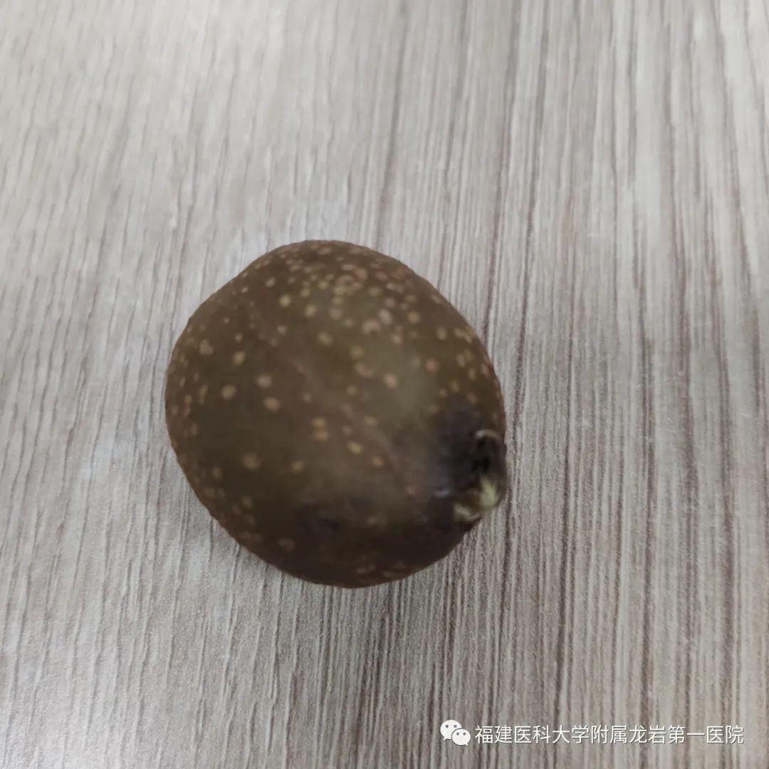急性肺水腫|“一個野果差點要了我的命”