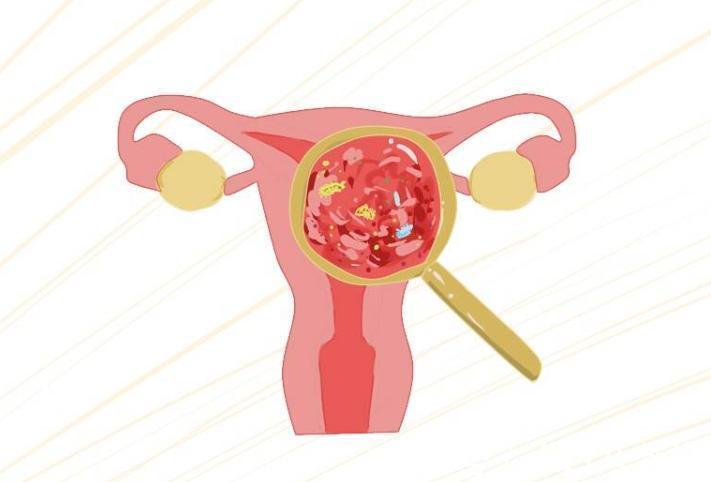 孩子们|55岁大妈下腹疼痛,查出宫颈癌,医生:女人不要太节俭,小心HPV