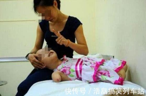 双胞胎|双胞胎被查出“畸形”,准妈妈不顾劝阻坚持生下,是自私还是母爱