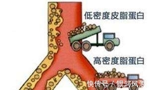 低密度脂蛋白|血脂降到正常范围以后，还用继续吃药吗？