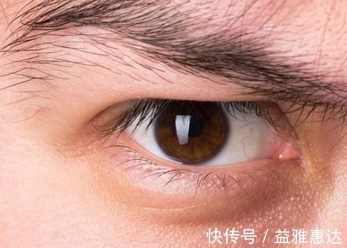 眼睛|做近视手术到一半，如果眼睛动了、眨了，会怎么样？