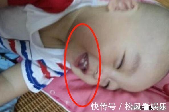 反应力|3岁儿子总是咧嘴笑,姥姥看后急忙送医院,医生幸好来得及时