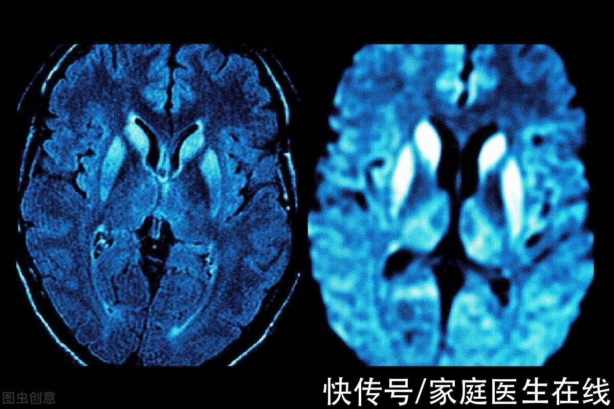 血管|中老年人血液循环不畅？做好这4件事，或许能让血管更通畅