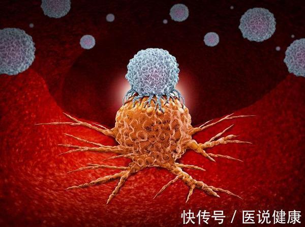 癌变|诱发肺癌的原因,不仅是抽烟!医生:这4点也是肺癌的相关因素