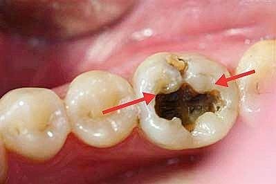 哪些疾病需要在备孕的时候处理，否则怀孕后可能会后悔莫及？