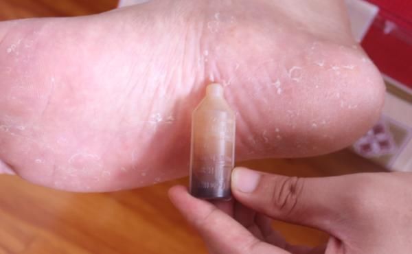 藿香正气水涂在脚上太厉害了,解决了很多人的困扰