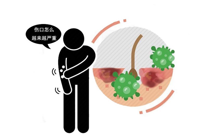 患者|胰腺癌被称之为“癌症之王”！身体莫名其妙5个异常，别大意了！