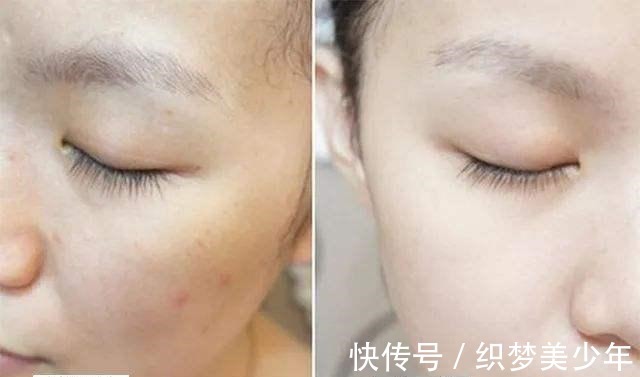 美白淡斑|脸上有色斑,巧用胡萝卜加它敷脸,15天恢复白净,妹子们别错过了!