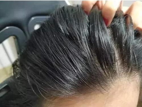 头发一直脱？别犯愁，你可能不是真的掉发！避免入坑看这里