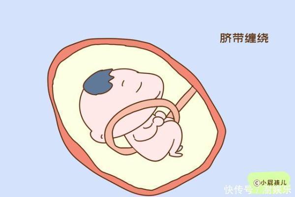 怀孕|怀孕的时候翻身太频繁,可能影响胎儿的正常发育,孕妈要注意