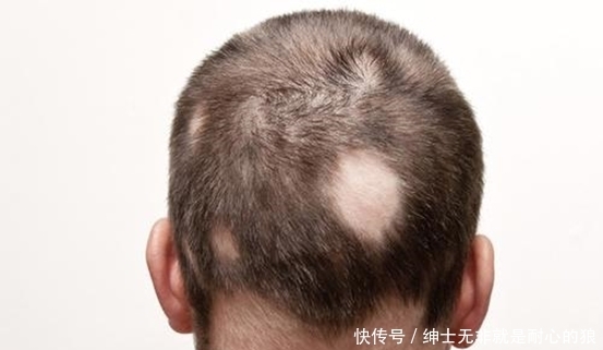 中医|91岁退休中医:常用1种食材泡水喝,肝脏年轻20岁