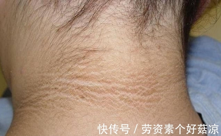 妈妈|6岁小女孩脖颈发黑洗不掉,去医院做检查,医生的话让妈妈笑了