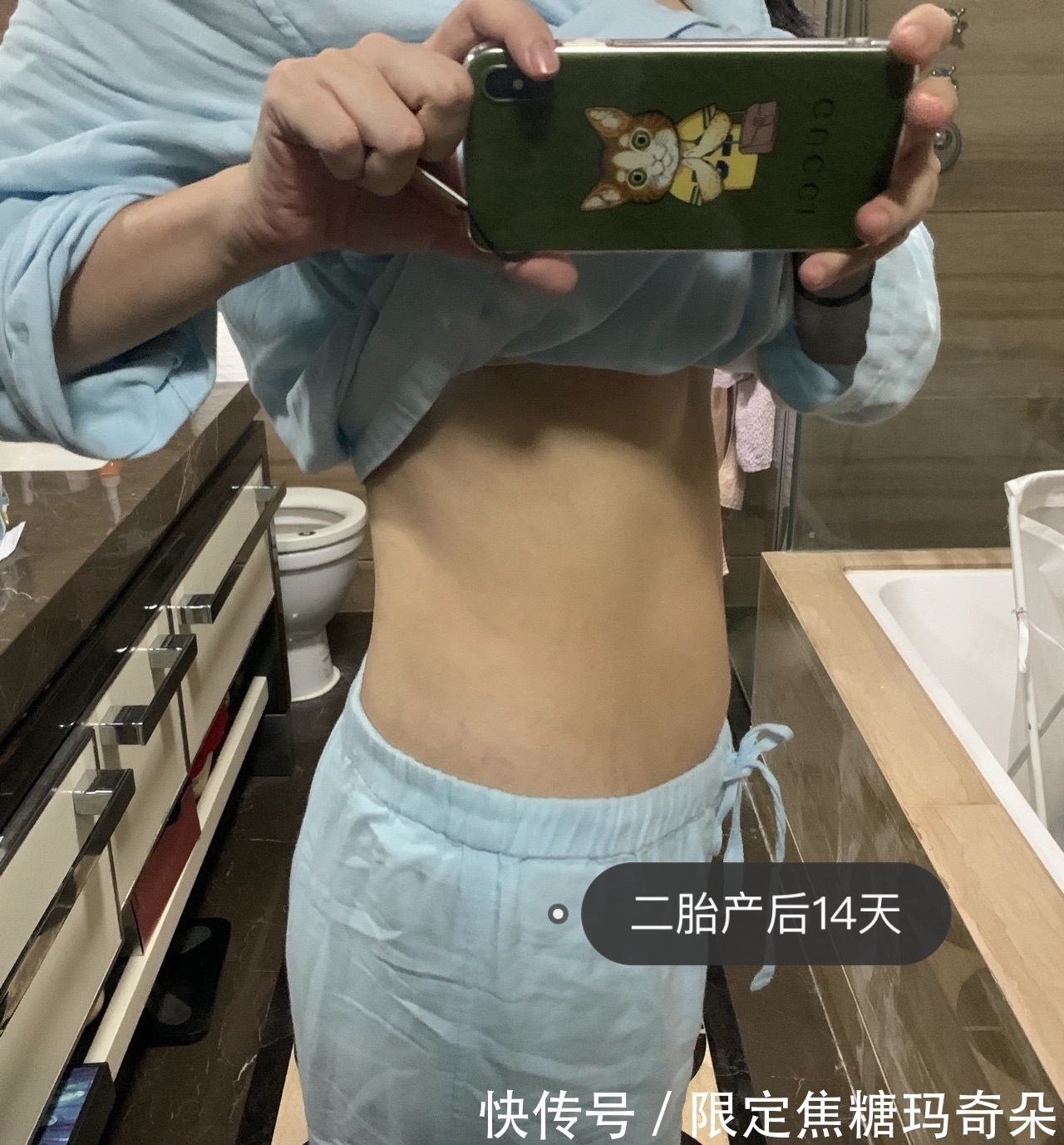 顺产|盆底肌自测|15秒居家测试,不需要任何仪器