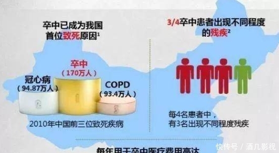 医生提醒:脑梗“源头”被发现,肥肉不是首位的,3物更要当心