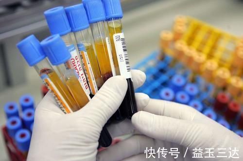 癌变|你的眼睑上有小黄瘤子吗?是不是血脂高的象征?营养师说出答案