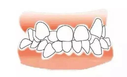 牙齿|牙齿三个 “关键期” ,千万别错过!否则毁掉孩子一口好牙