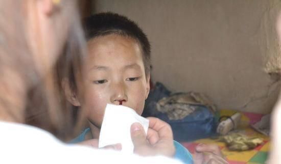 医生|4岁宝宝半夜突然流鼻血,送到医院后,医生的话让妈妈无法接受