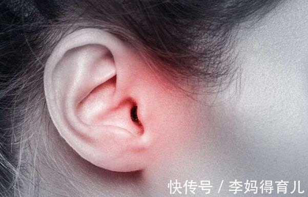 血液粘稠|内科医生：血脂升高，脸部会给你“暗示”，及时检查，不要拖延