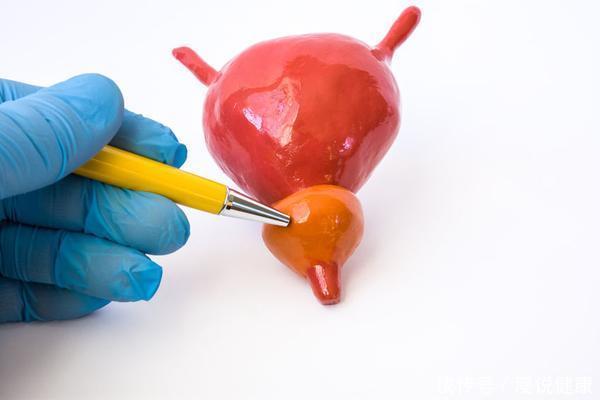 肿瘤|膀胱癌来袭,身体会出现这3个暗号,发现1个就最好去查一查