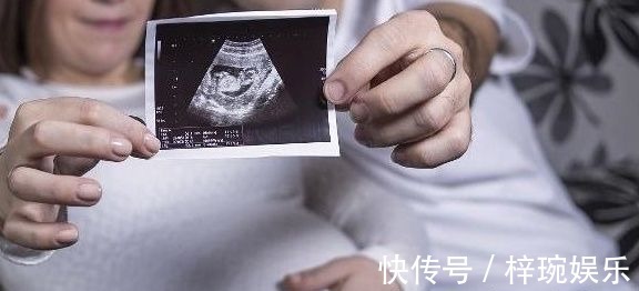 羊水|为什么有的孕妇显怀时间比较晚？可能这4个原因比较“关键”