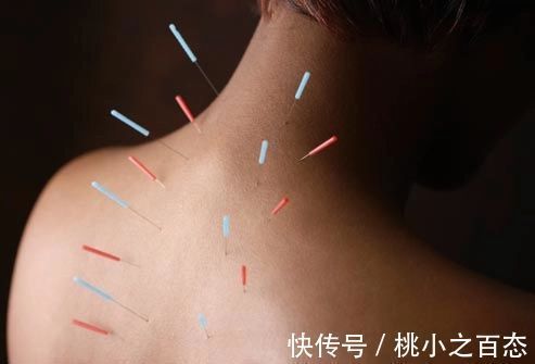 口服|肩周炎、腰腿疼有救了!新型疗法为千百万人解决颈肩腰腿痛的烦恼