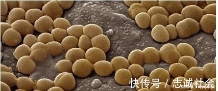 妈妈|8岁小孩出去玩,回家不洗手按了个手印,妈妈培养48小时后