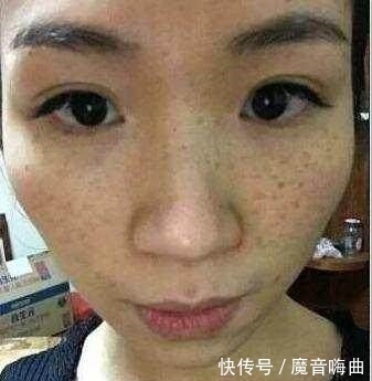 祛斑|老奶奶的祛斑秘籍,睡前用它敷面膜,脸上不长斑点和皱纹
