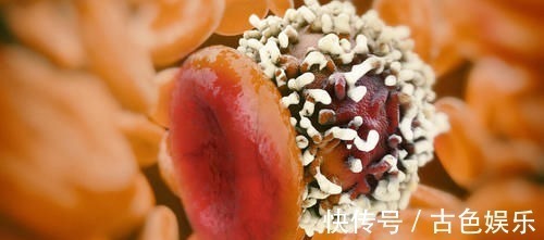 毒素|癌症不是突然出现,从无到有分6步。医生提醒:预防关键是前4步