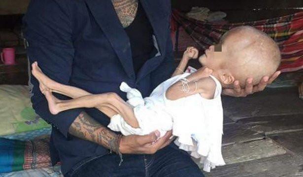 小宝宝|12年前喝“三鹿奶粉”的孩子,如今变成了什么样?网友:心疼孩子