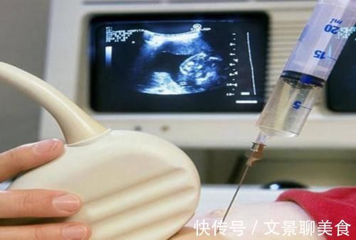 生殖器官|孕期想知道“胎儿性别”?这些方法可以测出,民间的说法不可信