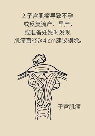 切除|得了子宫肌瘤就一定要切除？看看医生怎么说