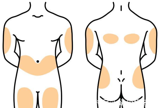 口服降糖药|胰岛素对糖尿病真的好吗?医生:胰岛素的六大不良反应,不得不防