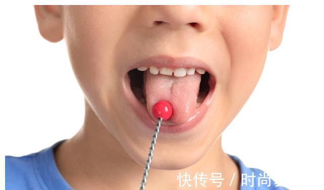 医生|2岁多孩子说话“结巴”,医生问清情况后痛批家长!