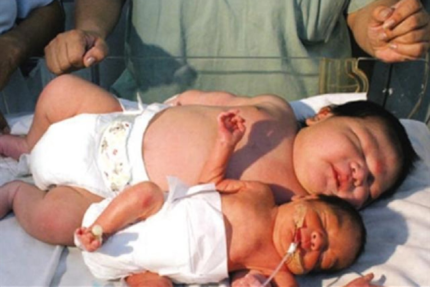 产科医生带你看，5斤和8斤的胎儿的大小差异，产妇很遭罪