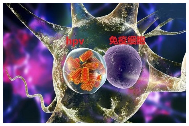 识别|46岁女子感染HPV不自知,认清2个“症状”,助你尽早识别