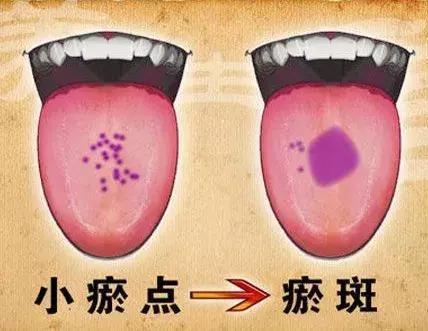 舌诊|中医医生总看舌头都在看什么九种体质+珍贵的舌诊图谱