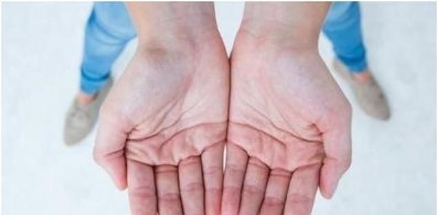 维生素老中医献方：手脱皮不要再撕了，1味中药煮水，洗一洗就好了！