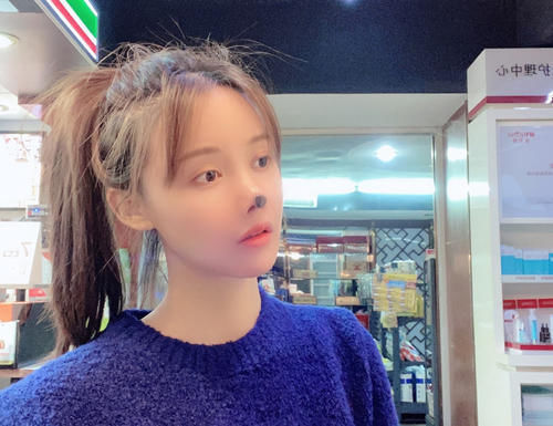 整形|高溜整形失败:整形市场乱象丛生,如此遭遇该谁赔偿?