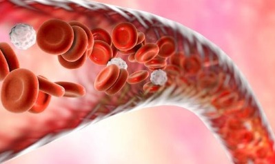 血压|血压高的人谨记不止是盐，3种食物也要少吃，不然血压爆表