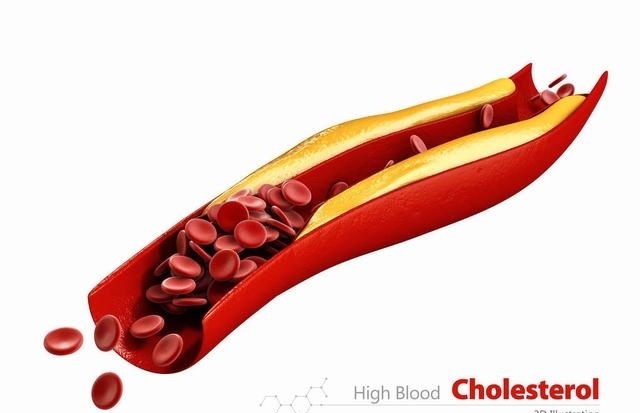 高血脂|血脂高的人不用怕,常吃3菜,多喝1水,清扫血液垃圾,血液不粘稠