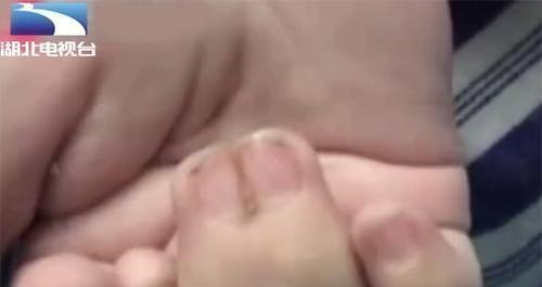 指头|罕见!新生儿有25根指头,一看到妈妈的手,医生瞬间明白了