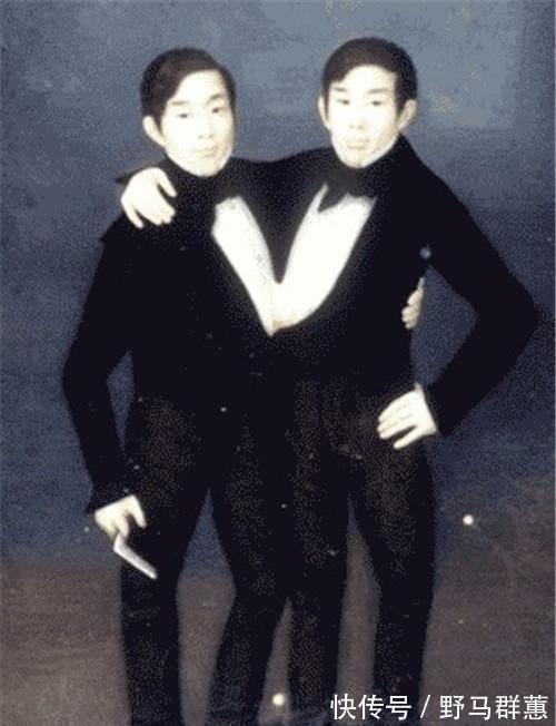 兄弟|这对华裔连体兄弟靠表演成名,娶了一对姐妹,生了22个孩子