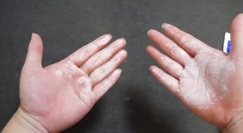 生活|小妙招把牙膏涂在手上太厉害了,现在知道还不晚,告诉家里人