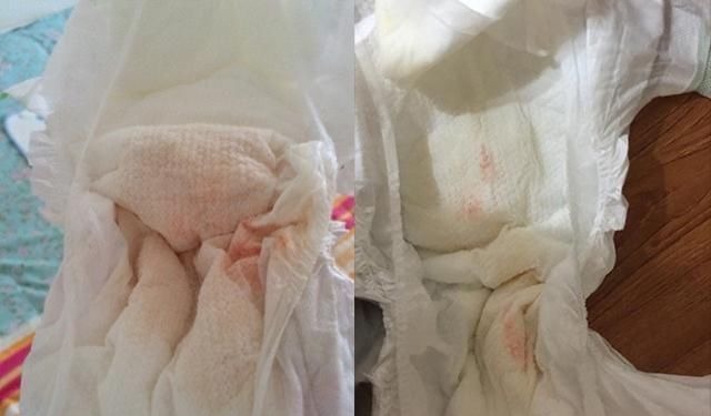 妈妈|“妹妹流血啦,妈妈快来”,面对意外,哥哥的反应让医生竖起拇指