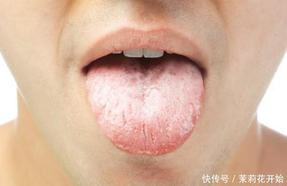 讨厌|4大脾胃“讨厌”食物，你喜欢几种早点知晓，少给脾胃增添压力